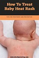 4 Best Ways To Treat Baby Heat Rash | Heat rash, Baby heat rash, Baby rash