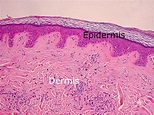 Dermis layers - Structure of dermis | the dynamic natural skin care