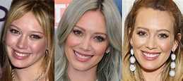 Hilary Duff Plastic Surgery Before And After Photos - Plastic Surgery Diary