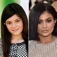 El antes y después de Kylie Jenner