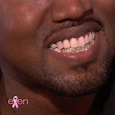Kanye West replaces his bottom teeth with diamonds | London Evening ...
