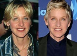 Ellen DeGeneres plastic surgery - Why she looks so young?