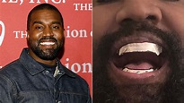 Celebrity teeth transformations: Dramatic before-and-after photos ...