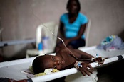 12 dead as Cholera outbreak hits Camerounian village - P.M. News