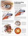 Glaucoma Action Plan and Toolkit Infographic | Charts, Fort collins and ...
