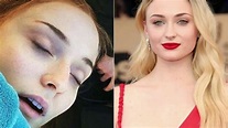 Sophie Turner Says She’s Experienced Mental Illness First Hand, Thanks ...