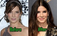 Sandra Bullock: Plastic Surgery Changed Her Nose? Before-After ...