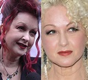 Cyndi Lauper Plastic Surgery Before And After Pictures | 2018 Plastic ...