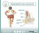 Tendinitis de aquiles o aquilea: Qué es, causas, síntomas, tratamiento ...