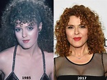 Bernadette Peters Plastic Surgery – A Perfect Look at Old Age – Celebrity Dr.