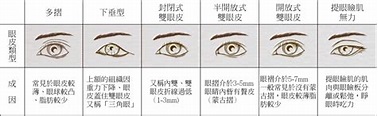 雙眼皮分類表