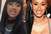 Cardi B Before Surgery – Did the Rapper Really Have Plastic Surgery