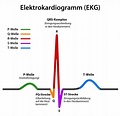 EKG » Anwendungsgebiete, Funktionsweise & Ablauf