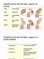 clasificacion de heridas.pptx | Cicatrización de la herida | Herida