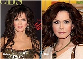 Pics Photos - Marie Osmond Plastic Surgery Before And After Photos Pics ...