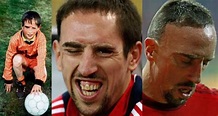 Franck Ribery reveals heartbreaking story behind scar on his face