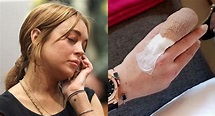 Lindsay Lohan perdió parte del dedo de la mano en accidente | TVMAS ...