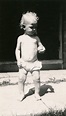 Baby in Diaper with Rickets | Photograph | Wisconsin Historical Society