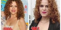 Bernadette Peters Plastic Surgery Before And After Photos