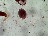 Balantidium coli – Trophozoite – Parasitology