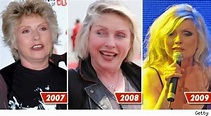 Debbie Harry Plastic Surgery Before and After Facelift, Botox ...