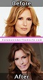 Tracey Bregman - THE BOLD AND THE BEAUTIFUL - Photos Before After ...