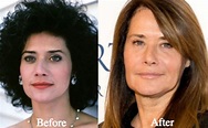 Lorraine Bracco Plastic Surgery Before and After Photos - Latest ...