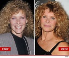Kate Capshaw: Good Genes or Good Docs? - Cosmetic Surgery | Kate ...