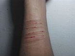 Hand Cuts | After Loving a wrong Person | Haris Khan Musazai | Flickr