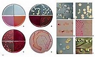 Escherichia coli - Wikipedia