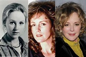 Bonnie Bedelia Plastic Surgery Before and After Pictures 2018
