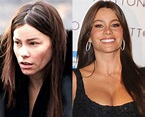 Sofia Vergara Before And After Plastic Surgery