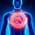 Paro cardiaco: qué es, causas, síntomas y primeros auxilios