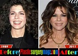 Rita Wilson Plastic Surgery Before and After | Plastic Surgery Magazine