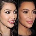 Antes y después Todas las operaciones de Kim Kardashian: antes y ...