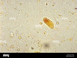 This photomicrograph depicts the cyst of an Iodamoeba buetschlii ...