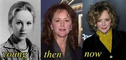 Bonnie Bedelia Plastic Surgery Before And After Photos