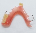 Prótesis parciales de acrílico – Dental Lab Direct