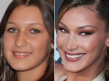 Bella Hadid avant et après : De 2010 à 2021