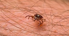 How to treat a tick bite and when to see a doctor | Oklahoma State ...