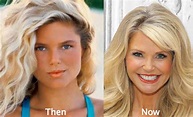 Christie Brinkley Plastic Surgery: Breast Implants, Botox Injections