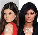[FOTOS] Mira el antes y después de Kylie Jenner