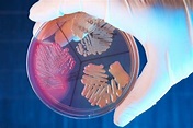 Staphylococcus epidermidis: o que é, sintomas e tratamento - Tua Saúde