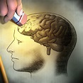 Other Types of Memory Loss - Alzheimer's Los Angeles