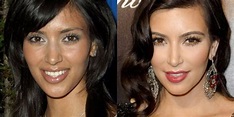 FOTOS: Kim Kardashian antes y después de las cirugías | Publimetro México