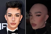 Did James Charles go bald? Why fans think he shaved his head