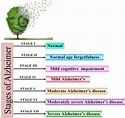 Different Stages of Alzheimer's disease. | Download Scientific Diagram