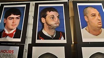 PHOTOS: Richard Norris, man who received most extensive face transplant ...