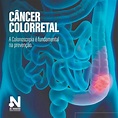 Câncer Colorretal | Dr. Norberto - Clínica de Especialidades