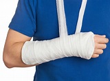 ¿Cuáles son los tipos de fractura de brazo y cómo se tratan? – Prensa Libre